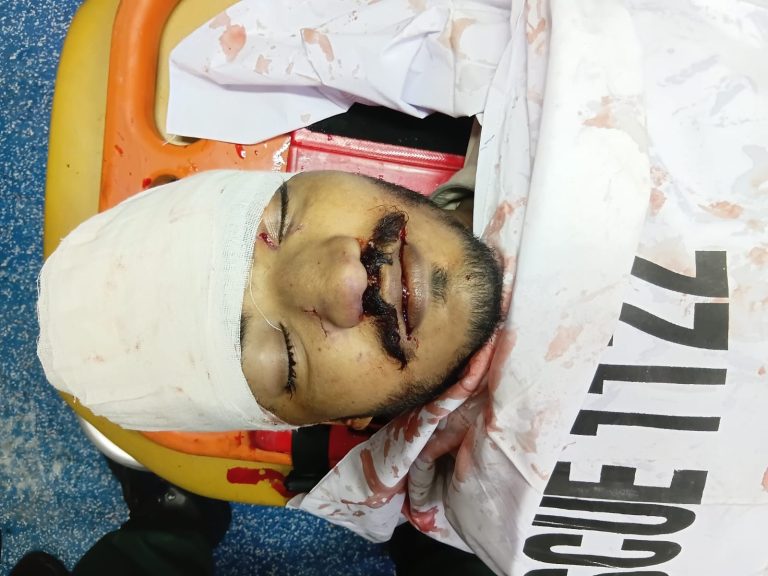 جہلم !جعفر مال جی ٹی روڈ کے قریب تیز رفتاری کے باعث موٹرسائیکل پیچھے سے ٹرک سے ٹکرا گئی، حادثے میں ایک 23 سالہ نوجوان جاں بحق جبکہ دو افراد زخمی ہوگئے